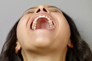 lingual ortodonti 3