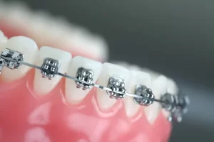 metal braketler 2